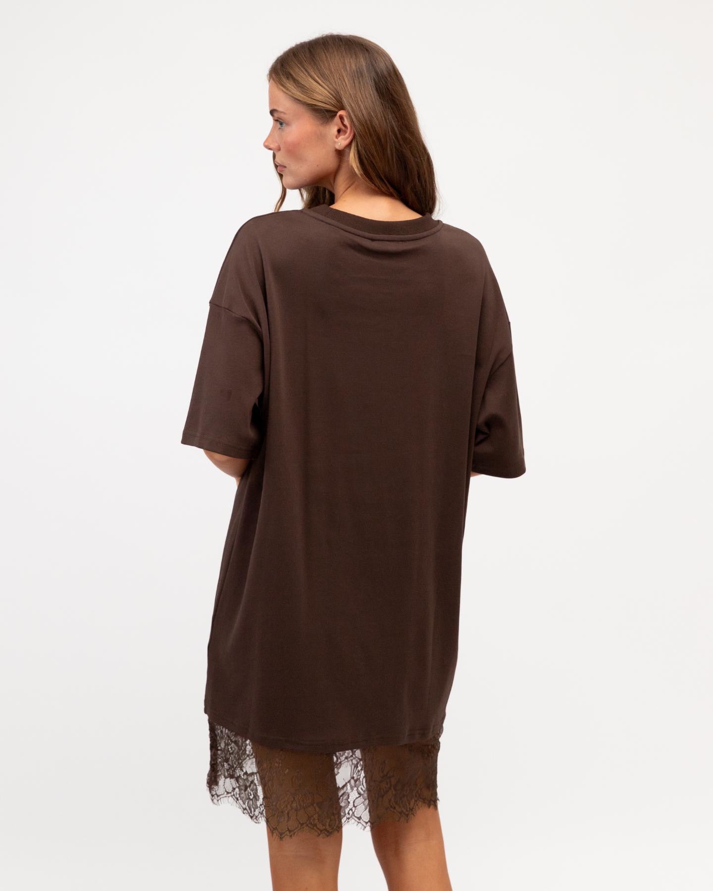 Willow Lace Tee Dress - close-up of delicate lace hem trim